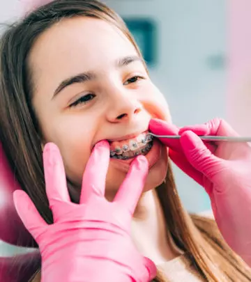 What Age Do Kids Get Braces? Types, Food And Dental Care