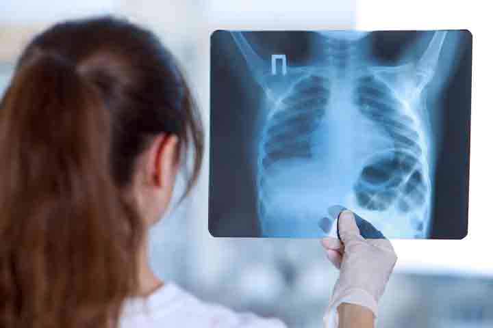 Chest X-ray to detect any sign of infection in the tissues, organs, and bones. 