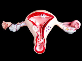How To Get Pregnant With Endometriosis? Chances And Best Age