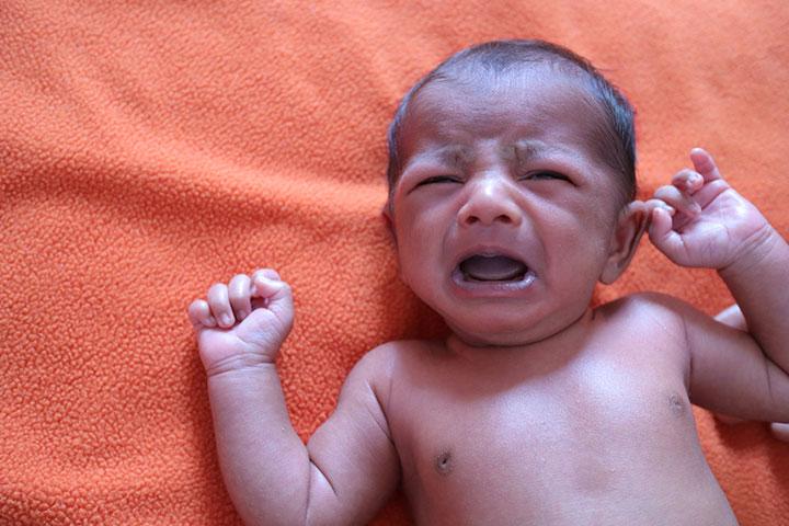 Baby Heat Rash: Types, Symptoms And Treatment