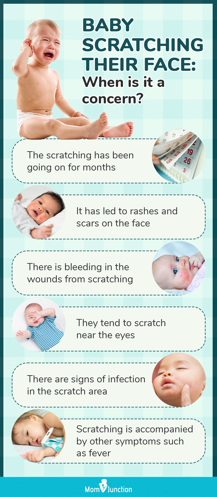 Clipped Baby's Finger When Cutting Nails? (Do This!)