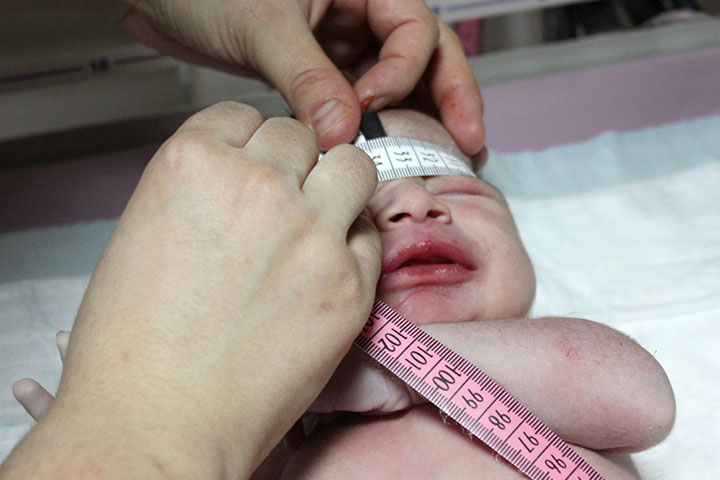 https://www.momjunction.com/wp-content/uploads/2022/09/Head-circumference-of-a-premature-infant.jpg