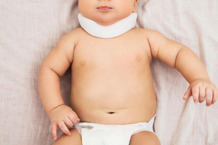 Torticollis may occur due to side sleeping