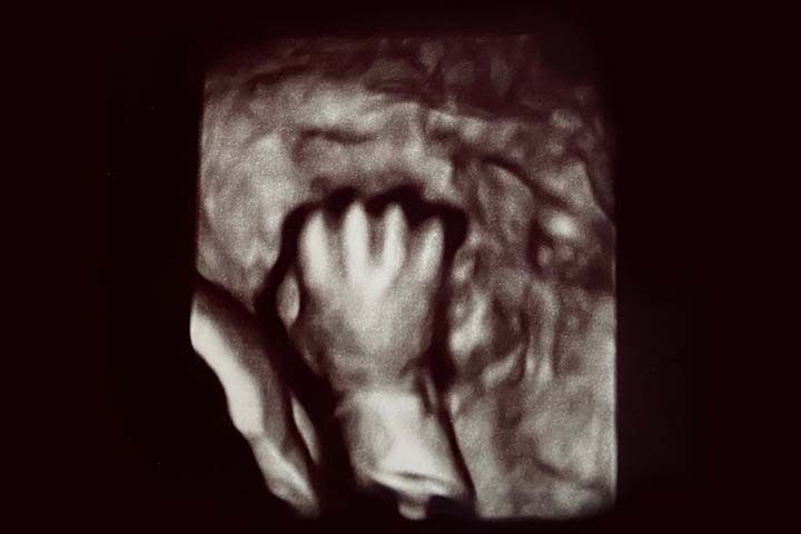 8th week ultrasound can detect tiny hands of the fetus