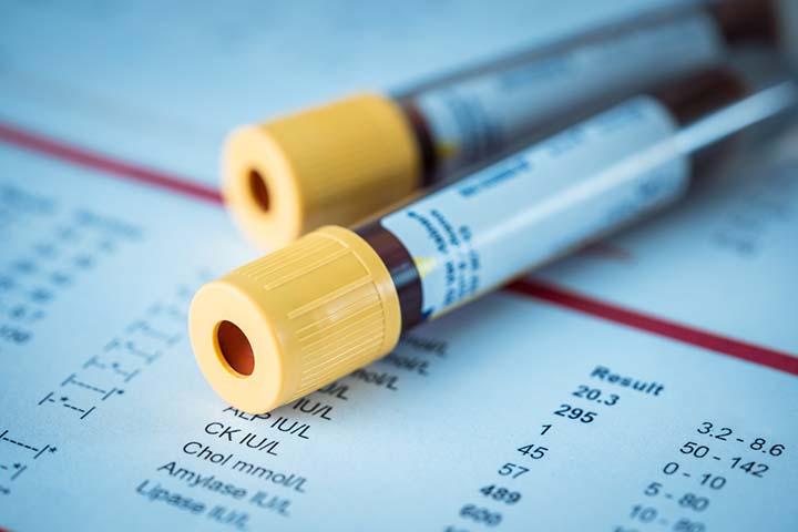 A blood test can determine if an infection is causing blood in the baby's stool