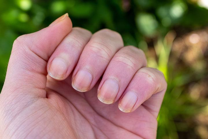 How your nails may change during pregnancy  Emmas Diary