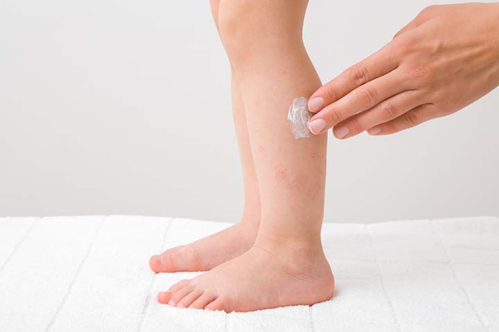 Apply an antibiotic ointment on the spider bites in toddlers.