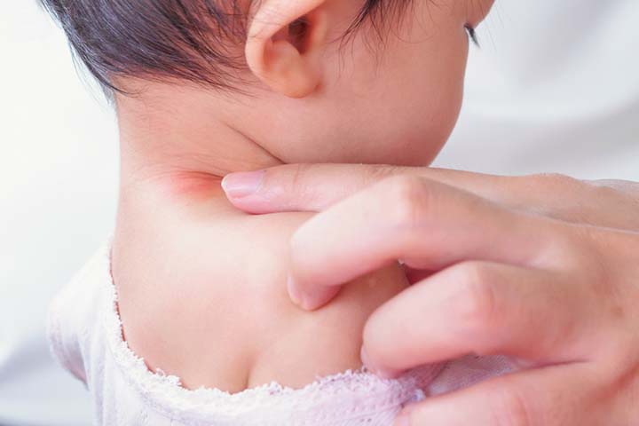 Babies may develop a rash as a side effect to the acetaminophen