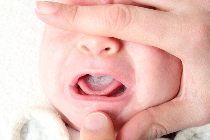 My baby fusses and cries sales during feeding