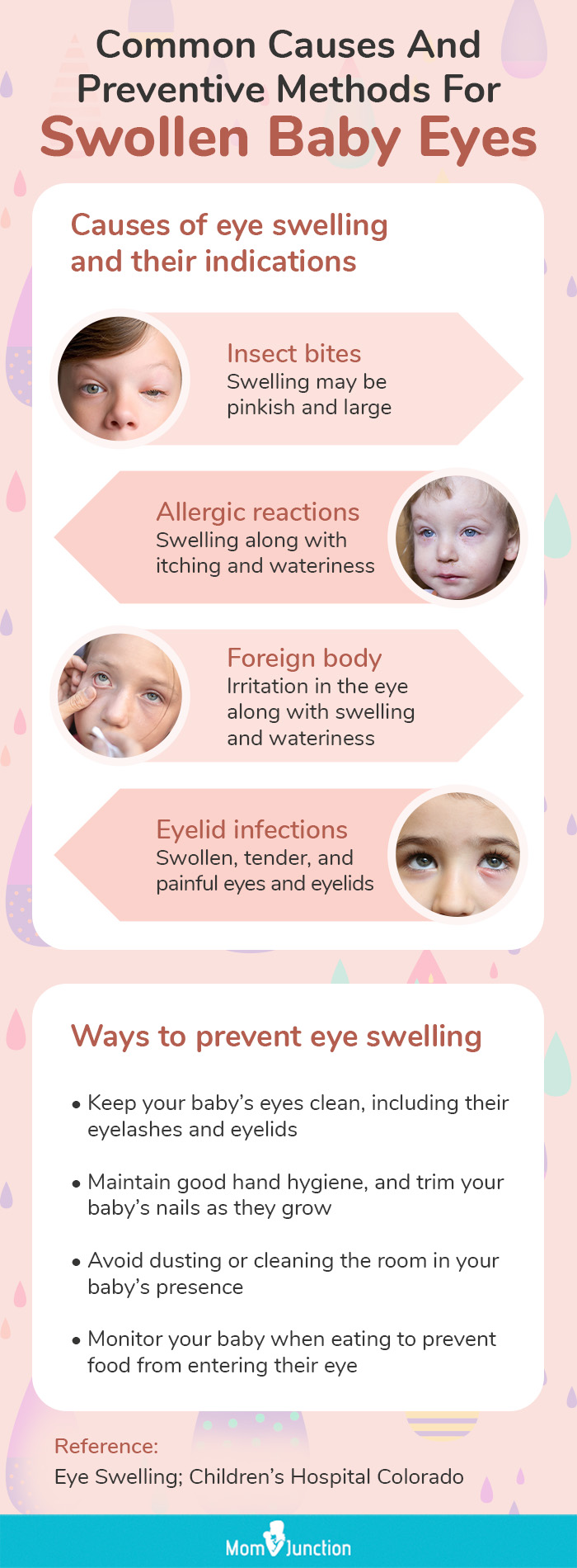 Toddler Has Bags Under Eyes - What to Do For Puffy Under Eyes Baby -  getkoreaneyes.com