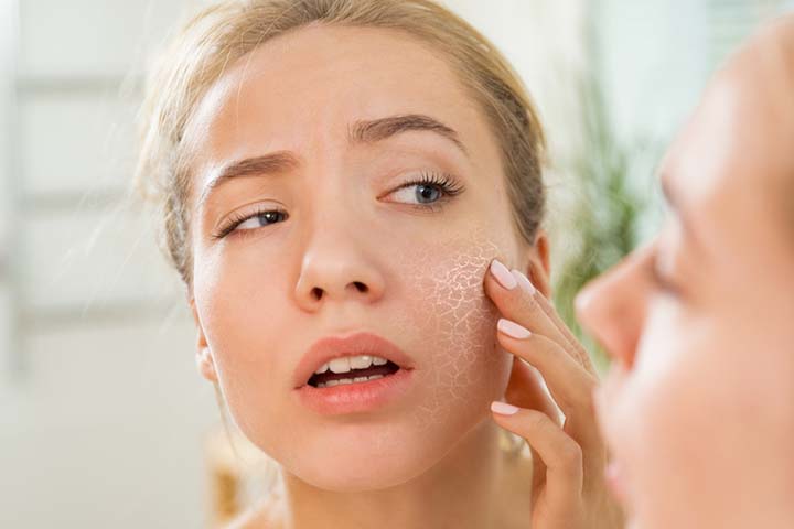 Dry skin is a problem in teens.