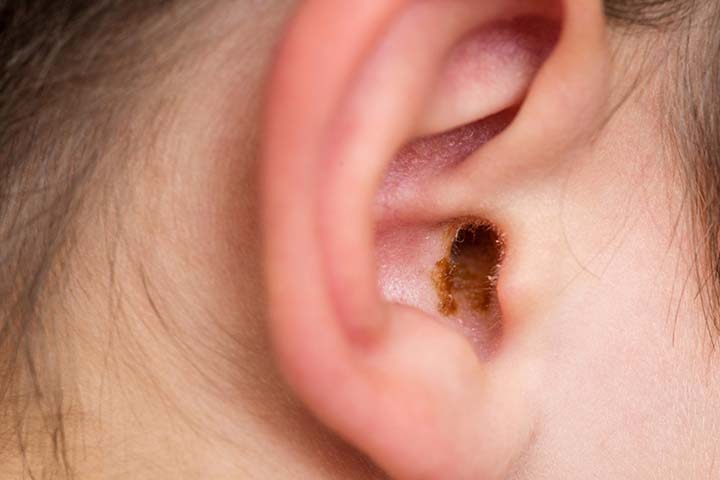 Visual safe and comfortable ear cleaning to cure children's ear phobia