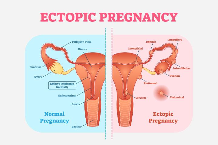 when is fetus viable