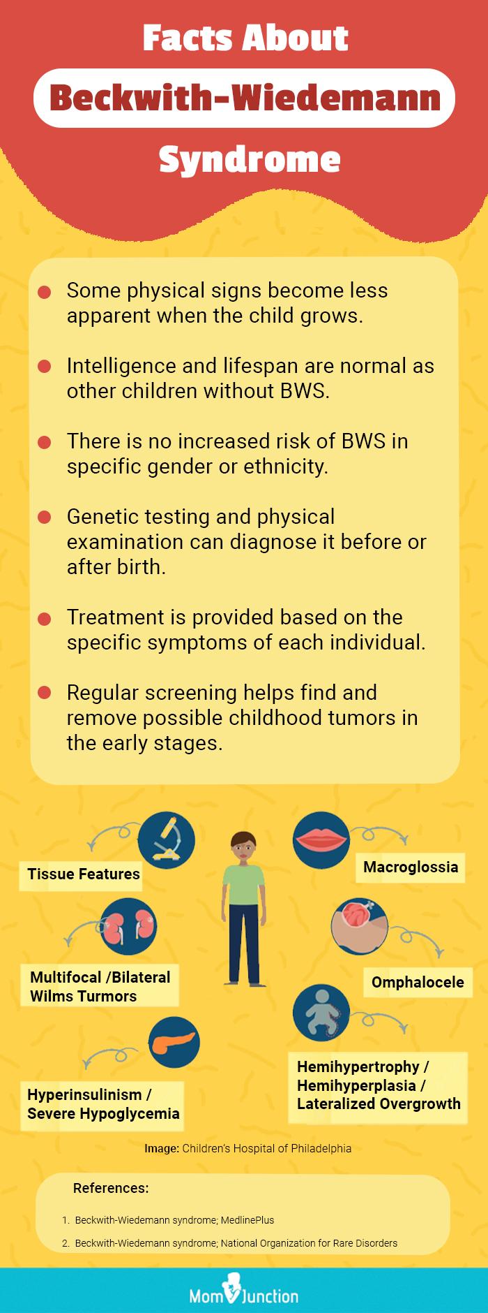 beckwith wiedemann syndrome adult