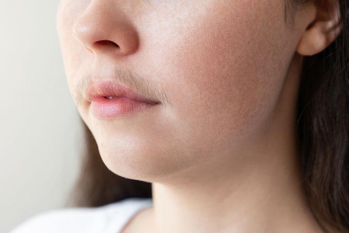 Why Women Get Chin Hair and Treatment Options  Cleveland Clinic