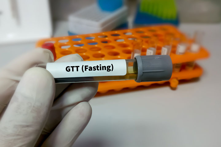 Oral glucose tolerance test 