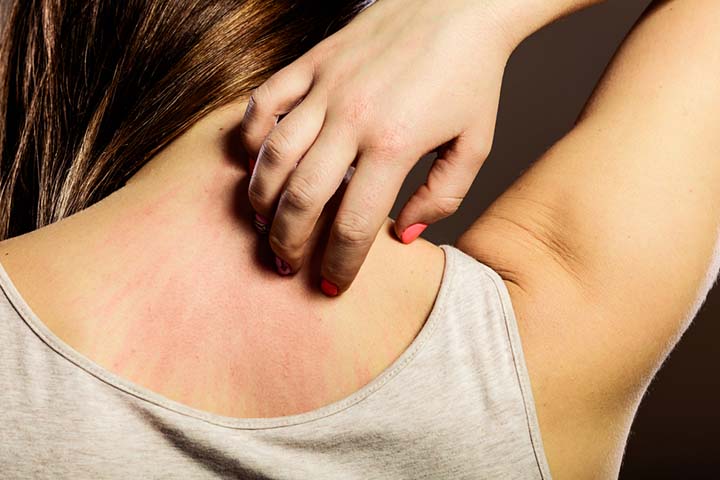 Skin rash may be a common side effect of phenylephrine