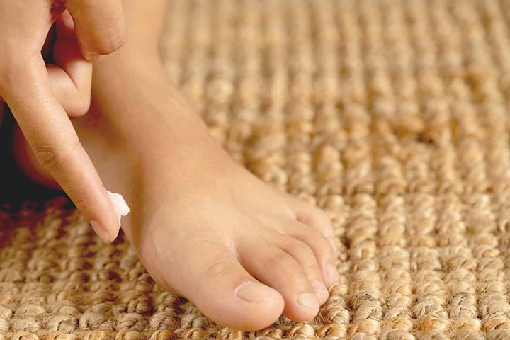 Itching in hands and feet - Causes, and Treatment