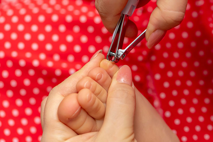 How To Treat And Prevent Ingrown Toenail In Babies?