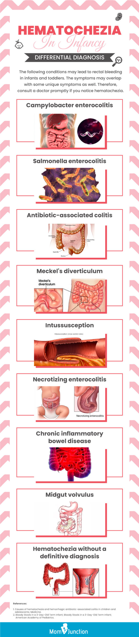 hematochezia in infancy differential diagnosis (infographic)
