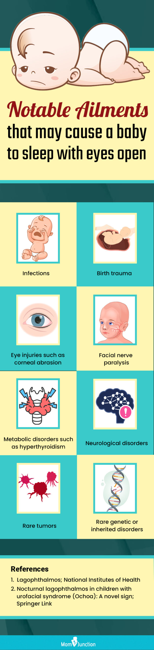 notable ailments that may cause a baby to sleep with eyes open (infographic)