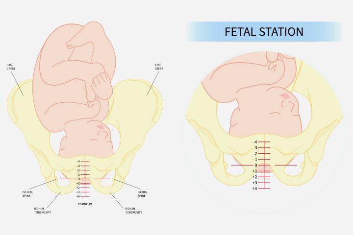 The head-down position is optimal for childbirth