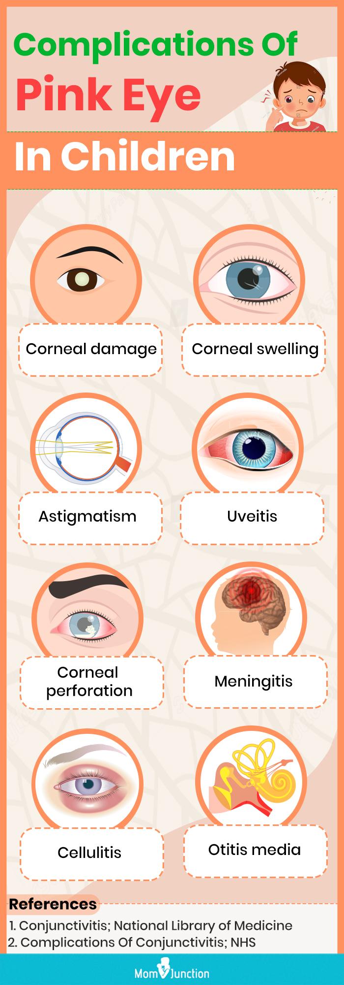 Eye Discharge: Causes, Types and Treatment