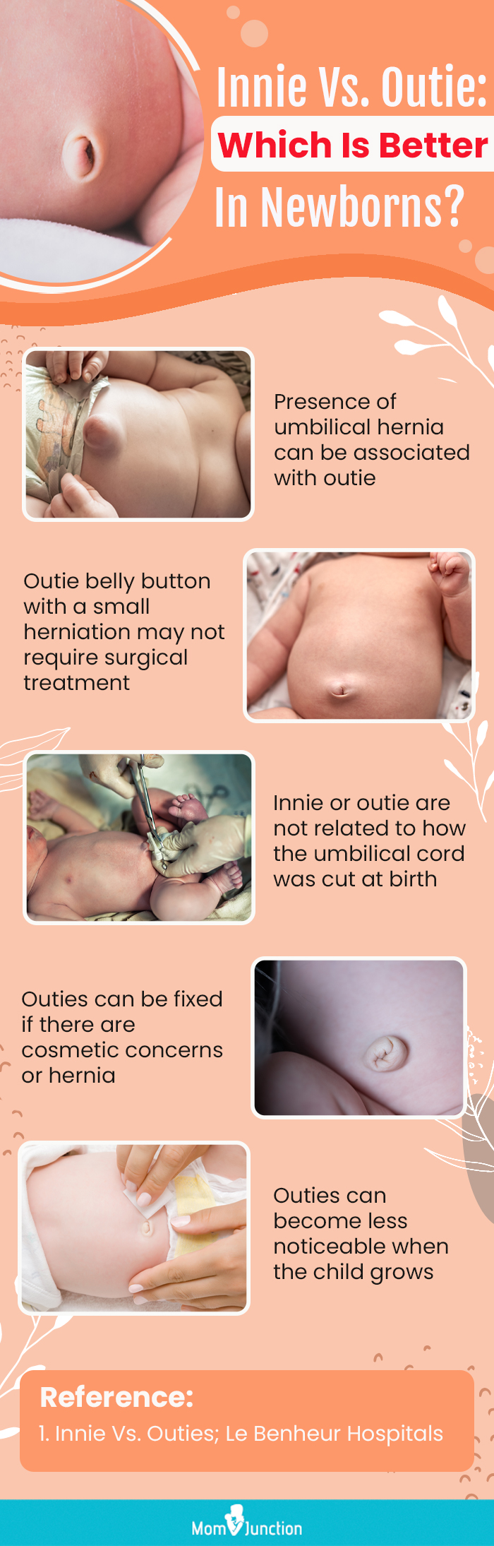 Outie Belly Button In Newborns: Causes, Symptoms & Treatment