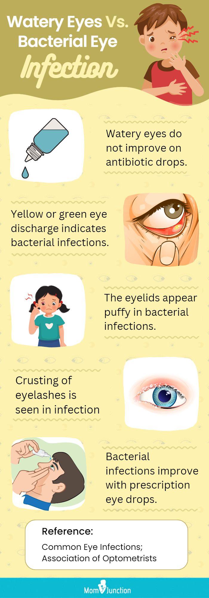 Watery Eyes: Causes, Treatment, and More