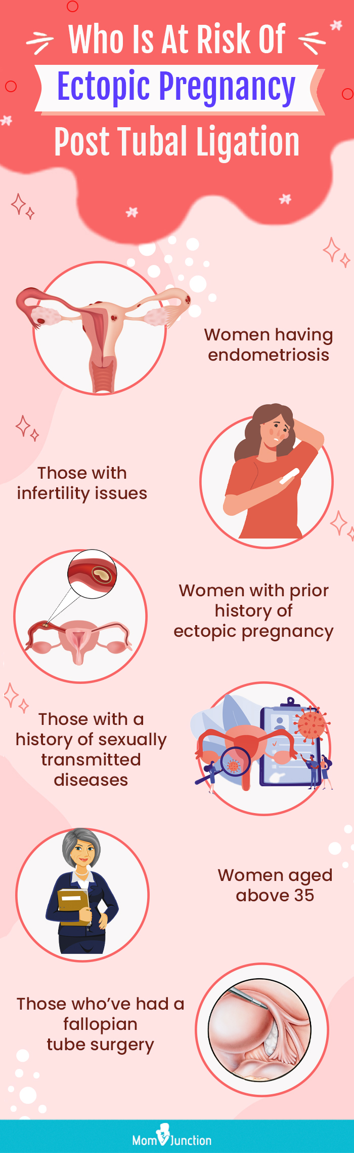 who is at risk of ectopic pregnancy post tubal ligation (infographic)