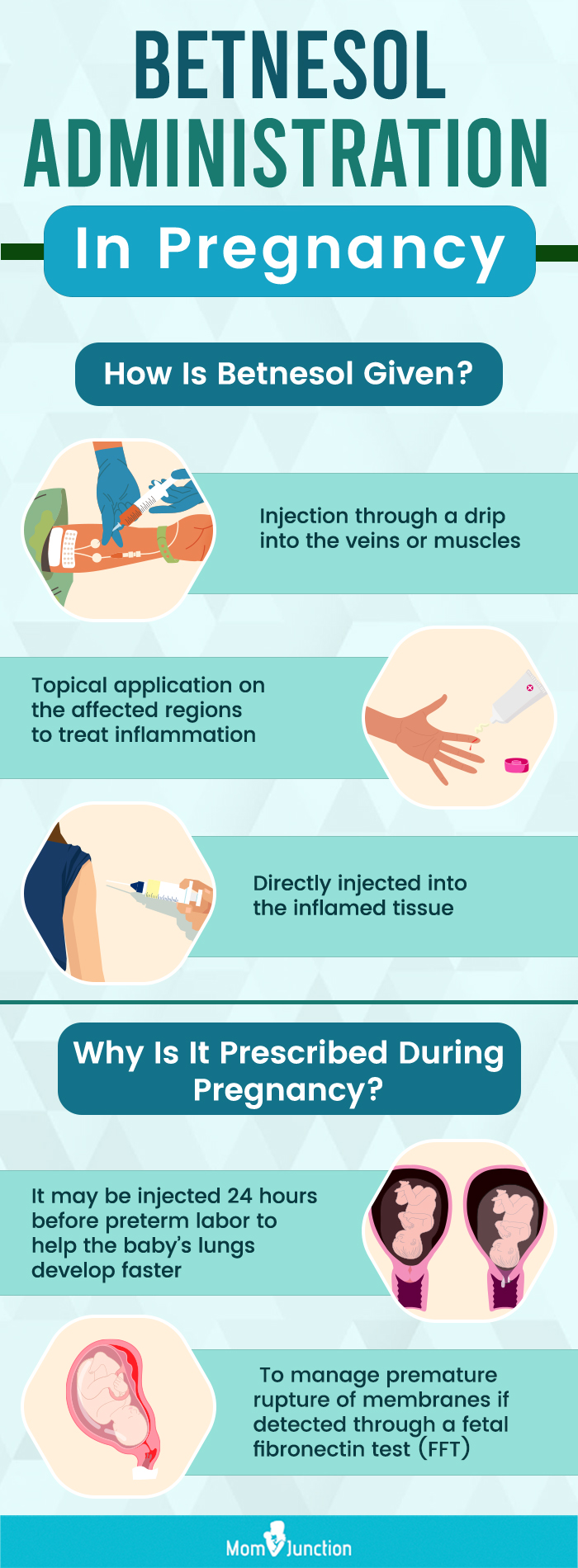 betnesol administration in pregnancy (infographic)