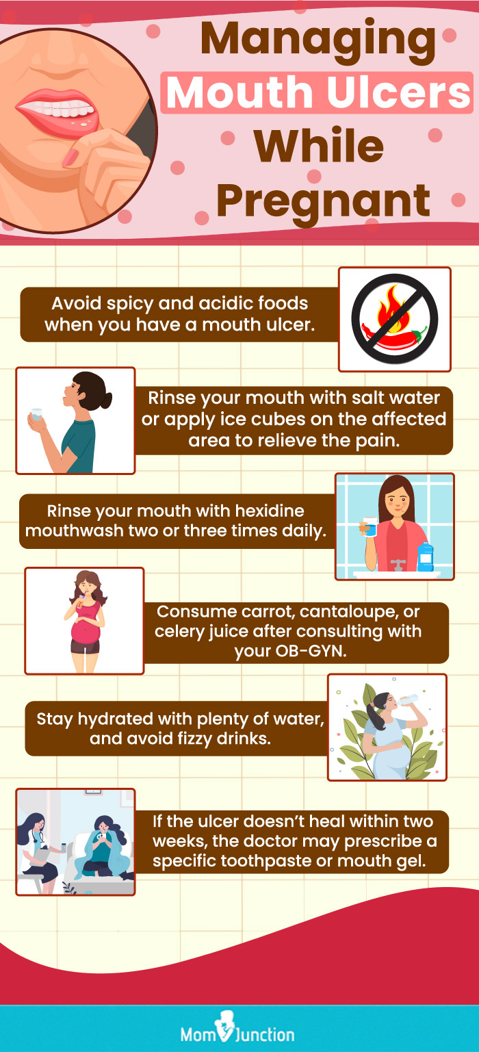 managing mouth ulcers while pregnant (infographic)
