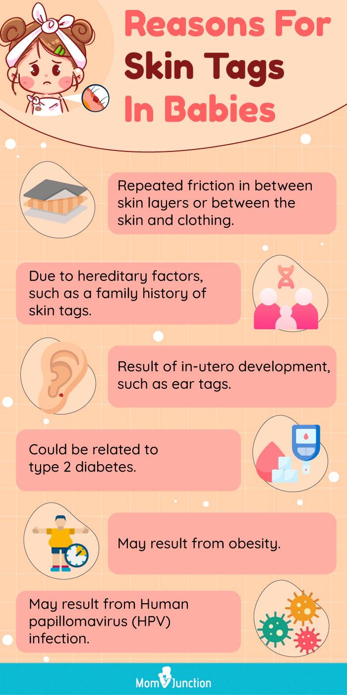 everything-you-need-to-know-about-removing-skin-tags-on-46-off