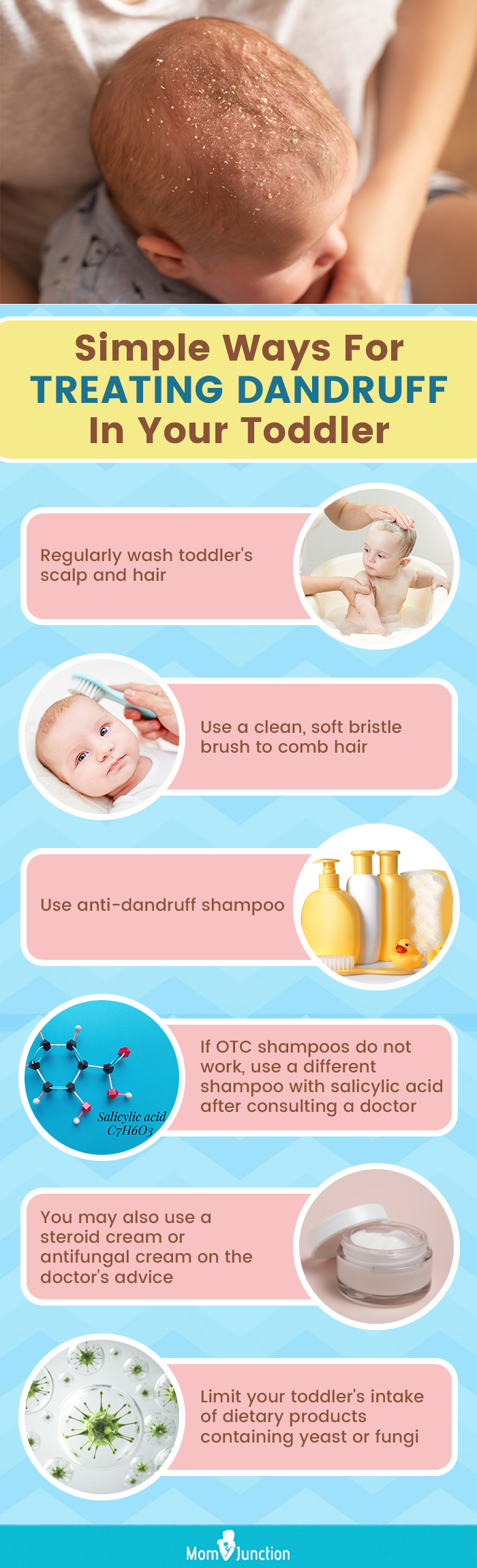 simple ways for treating dandruff in your toddler (infographic)