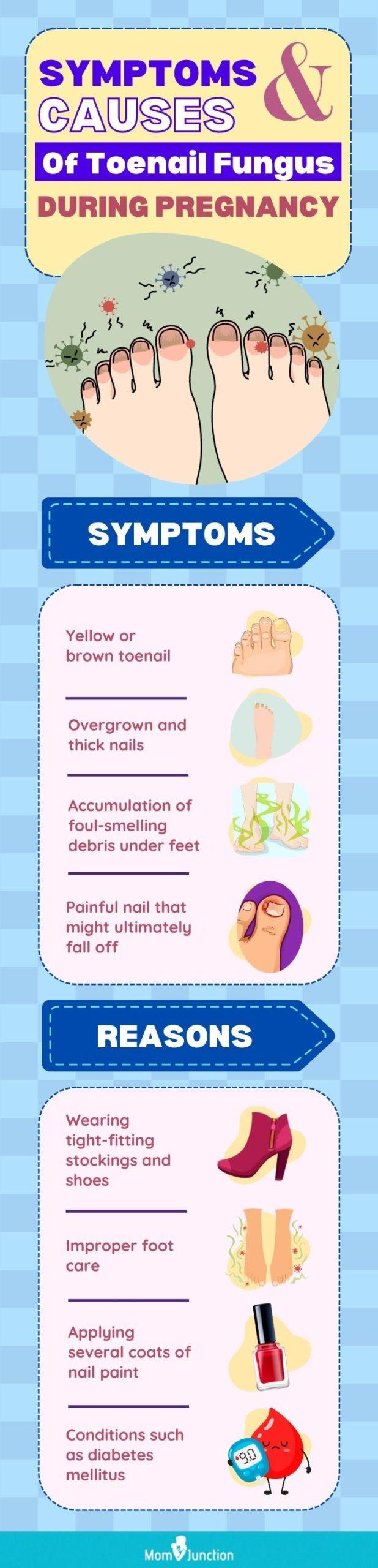 Can You Get Gel Nails While Pregnant - Urban Mamaz