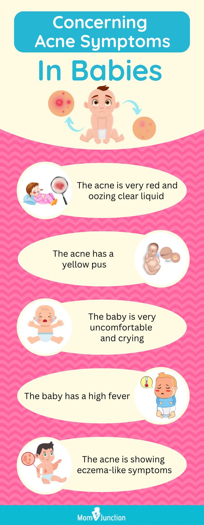 Baby Acne Causes, Symptoms And How To Get Rid Of It