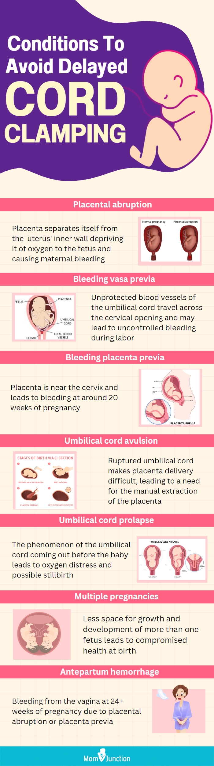 conditions to avoid delayed cord clamping (infographic)