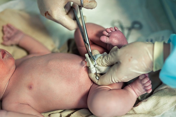Delayed Cord Clamping: Safety, Benefits, And Side Effects