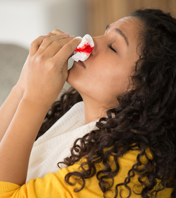 Nosebleeds During Pregnancy: Causes And Ways To Stop Them