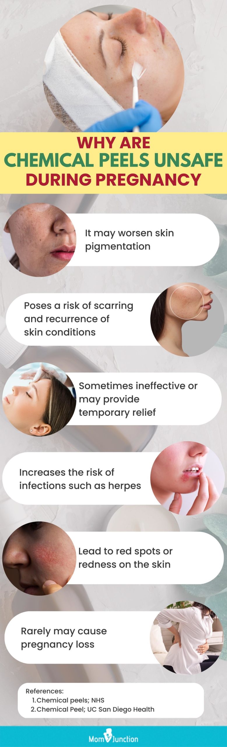 why are chemical peels unsafe during pregnancy (infographic)