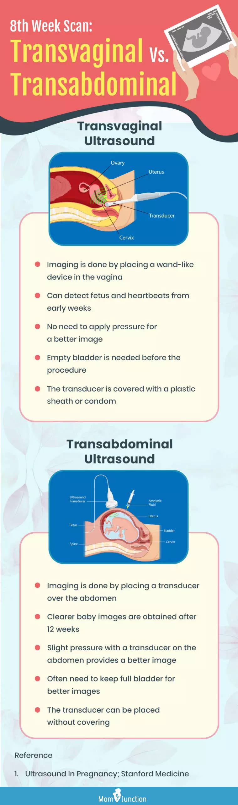transvaginal or transabdominal ultrasound in 8th week (infographic)