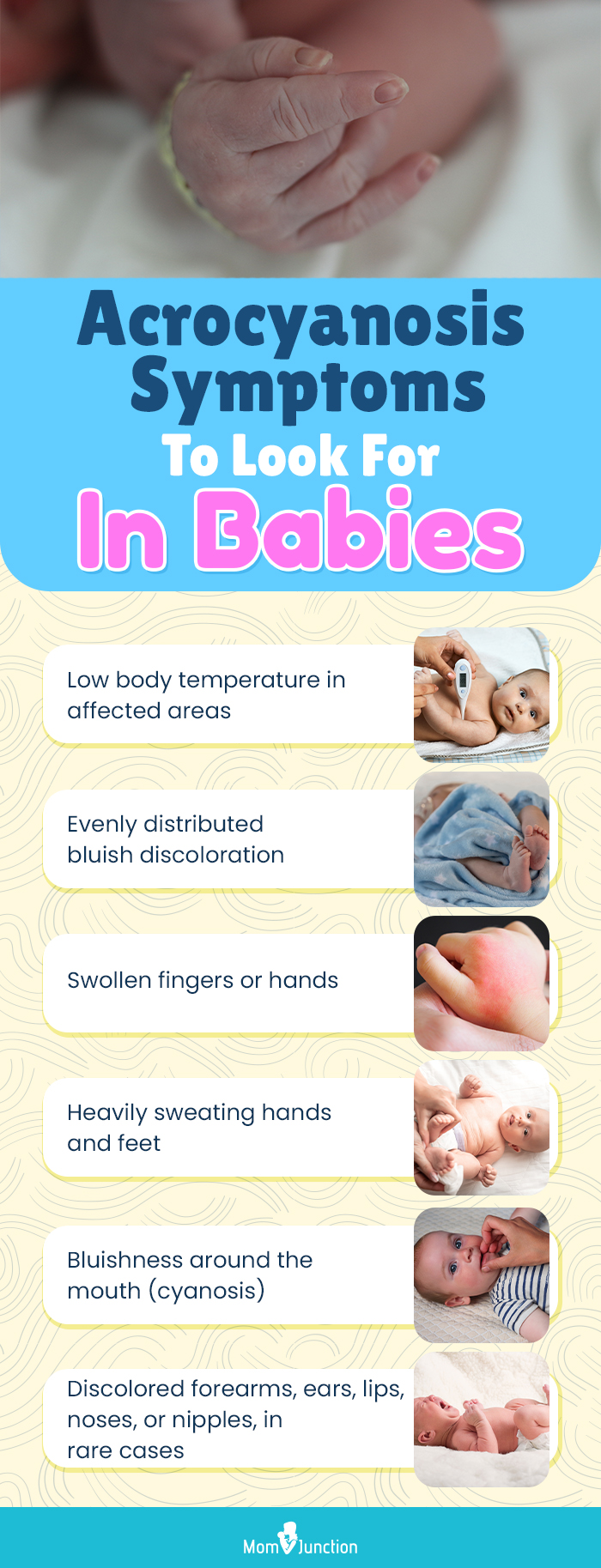 acrocyanosis symptoms in babies to look for (infographic) 