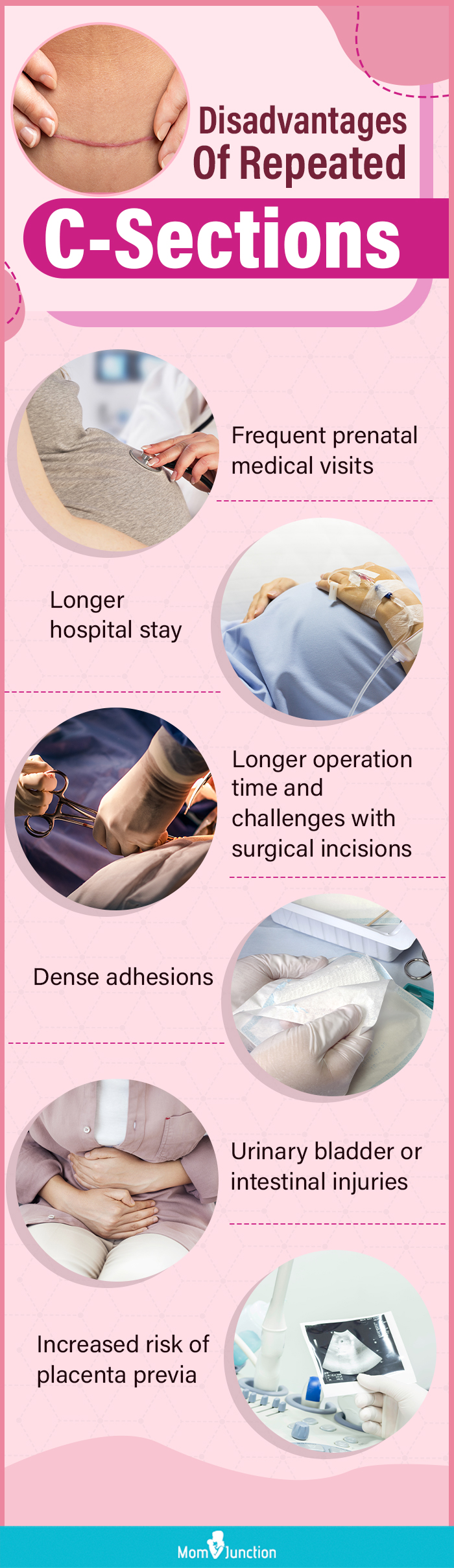 https://www.momjunction.com/wp-content/uploads/2023/05/Disadvantages-Of-Repeated-C-Sections.jpg