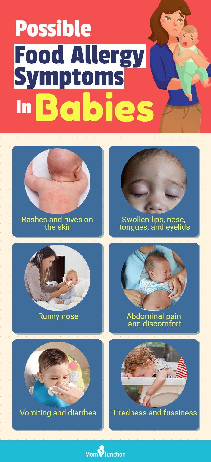 possible food allergy symptoms in babies (infographic)