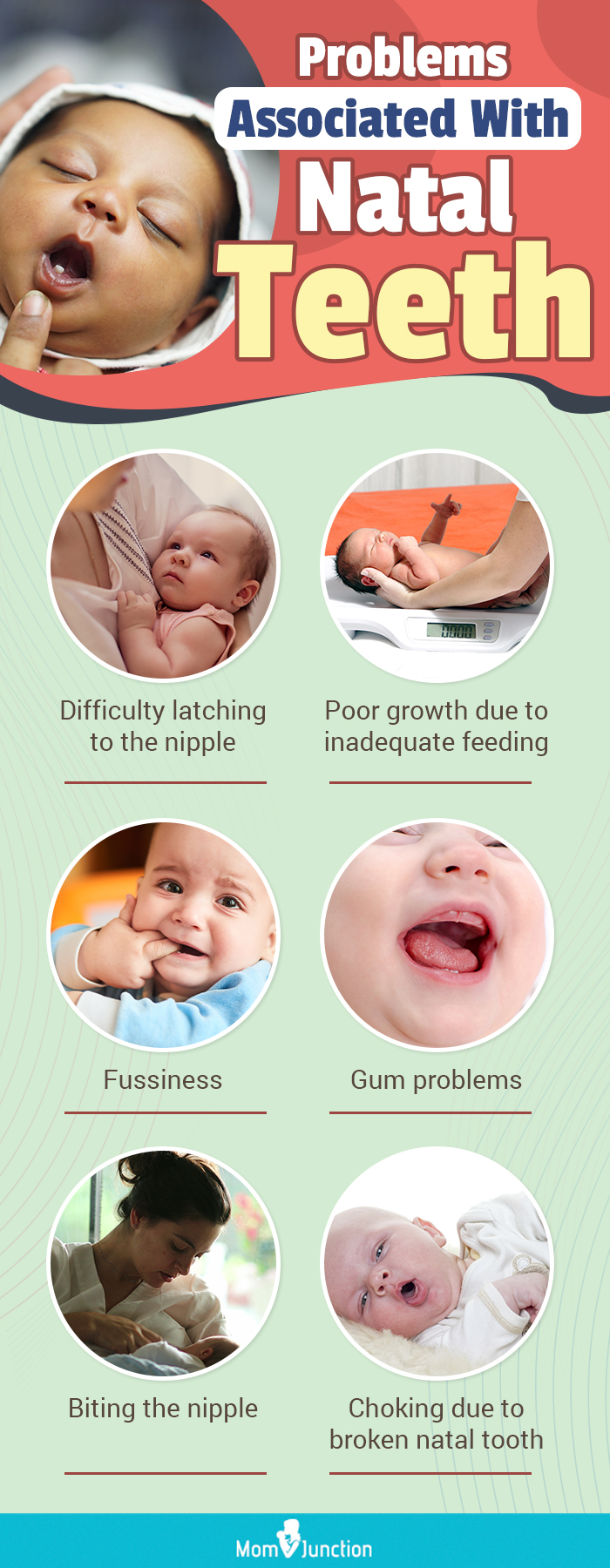 problems associated with natal teeth (infographic) 