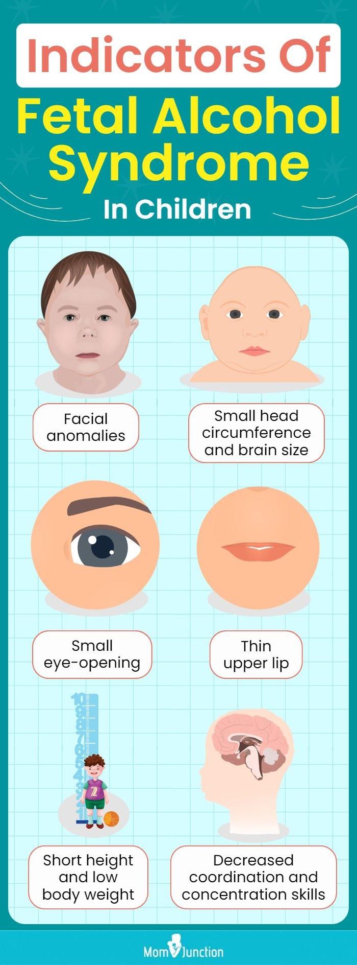 Child With Fetal Alcohol Syndrome FAS Symptoms Treatment 45 OFF child-with-fetal-alcohol-syndrome-fas-symptoms-treatment-45-off