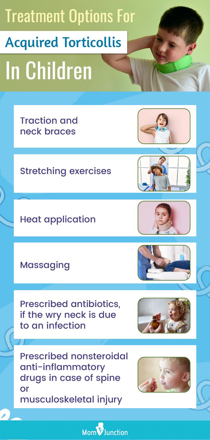 Torticollis what is it causes and more osmosis 41 off