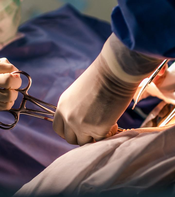 All You Need To Know About C Section